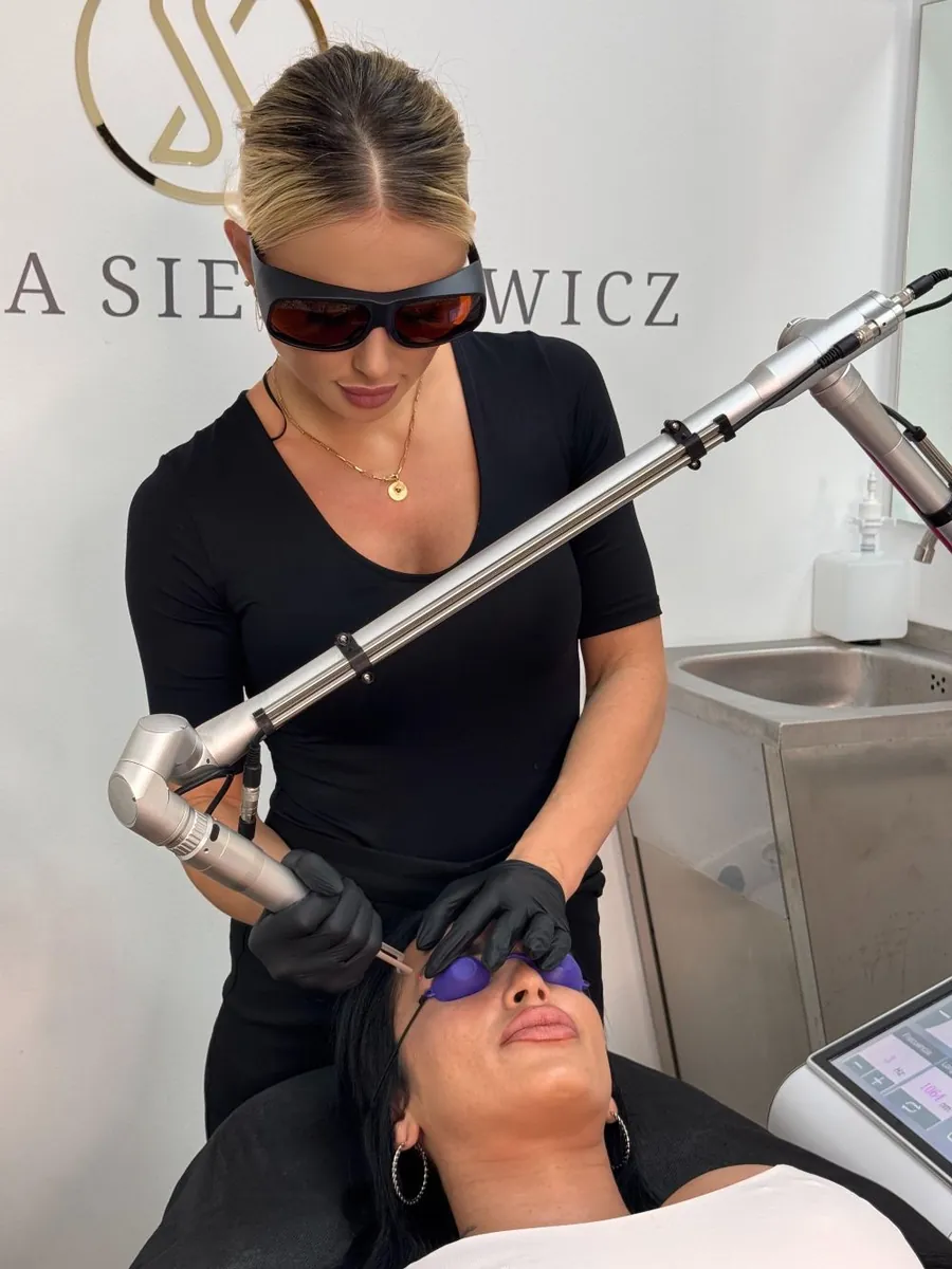 Sandra Sienkiewicz eliminando con láser la micropigmentación de cejas de una clienta